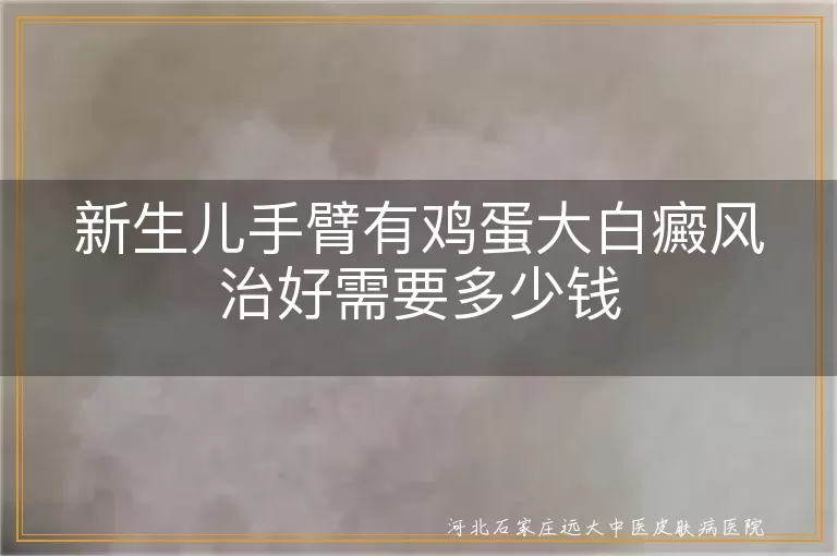 新生儿白癜风治疗价目,宝宝手臂白斑康复费用,婴儿鸡蛋大白斑治愈多少钱