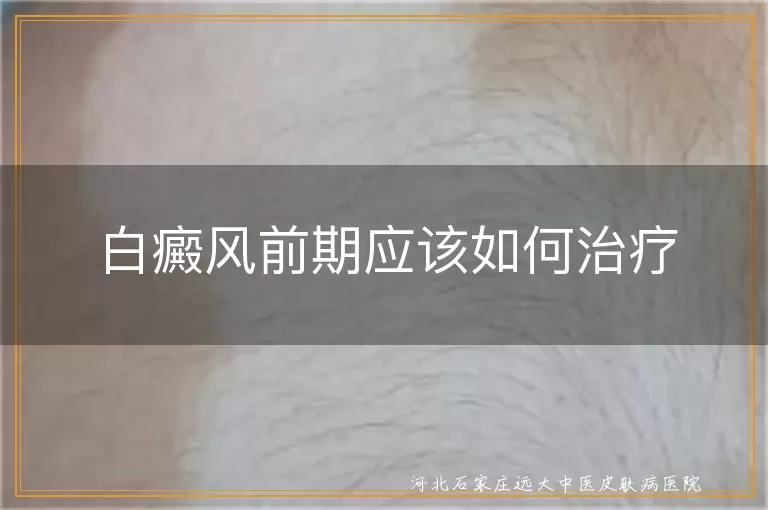 白癜风前期应该如何治疗