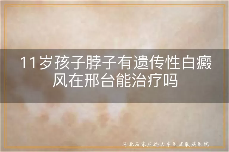 11岁孩子脖子有遗传性白癜风在邢台能治疗吗