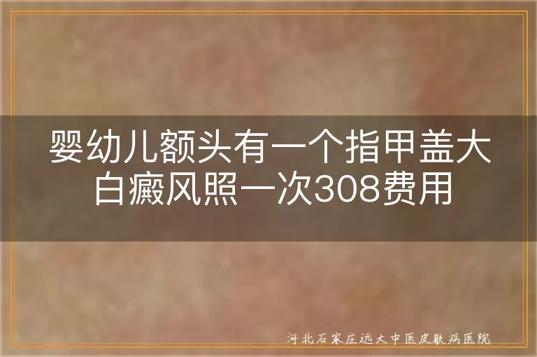 婴儿额头白斑照308费用,如何判断白斑是否白癜风,白斑治疗费用在线了解