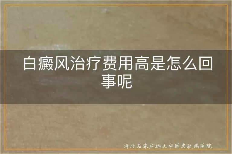 白癜风治疗贵的原因是什么,白斑花费高问题在哪,白癜风花费大与疗程关系