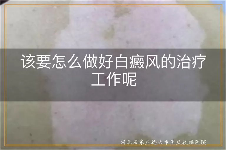 白癜风康复全攻略,白斑护理关键点,白癜风治疗注意事项