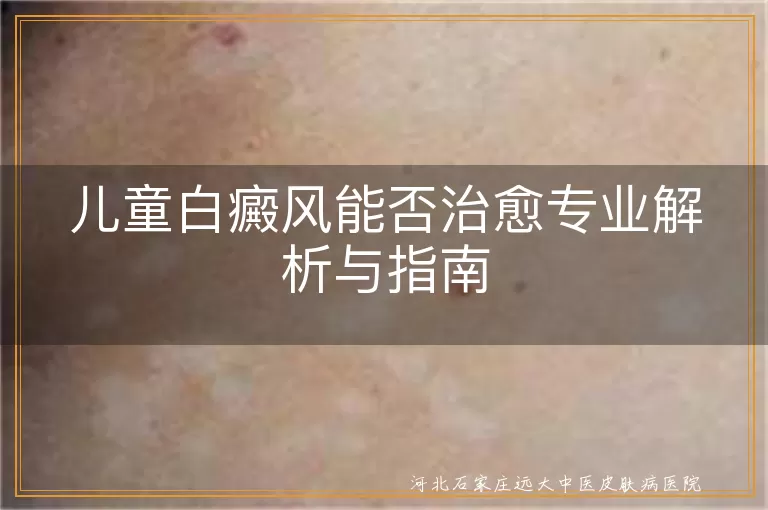 儿童白斑治愈可能性解析,白癜风康复家长指南,儿童白癜风治疗与护理要点