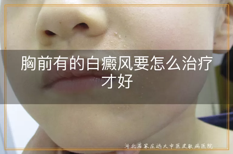 胸前白癜风治疗方案,胸前白斑应对策略,白癜风护理要点