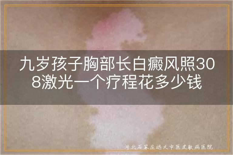 九岁孩子胸部长白癜风照308激光一个疗程花多少钱