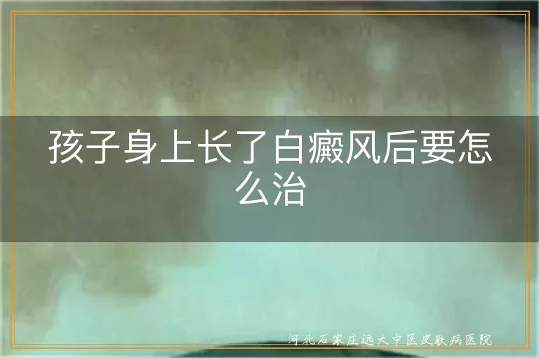 儿童白癜风这样才安心,别急白斑能治,孩子白斑别慌