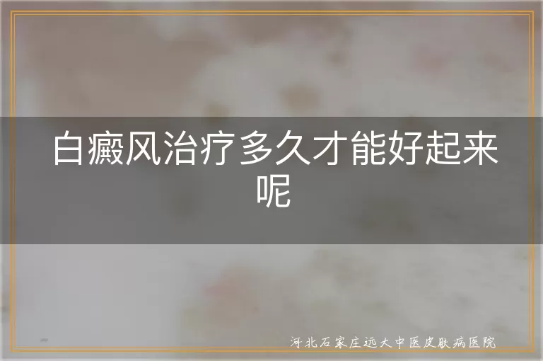 白癜风治疗多久才能好起来呢