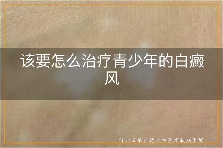 青少年白斑早治方案,青春期白癜风干预策略,中学生白斑日常管理