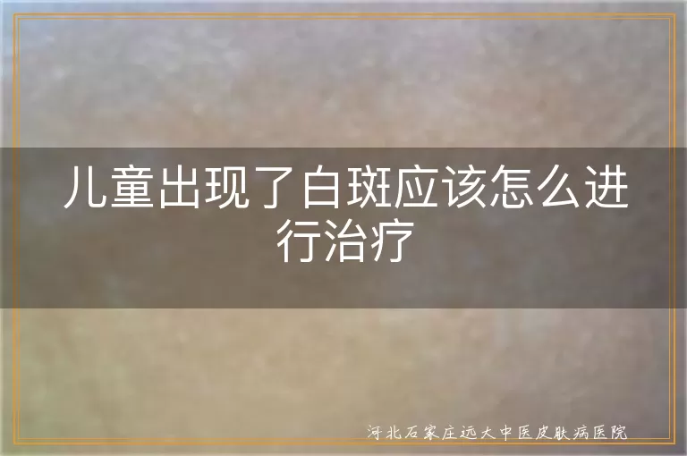 儿童出现了白斑应该怎么进行治疗