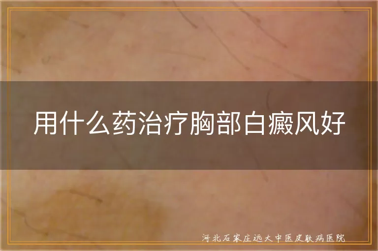 用什么药治疗胸部白癜风好