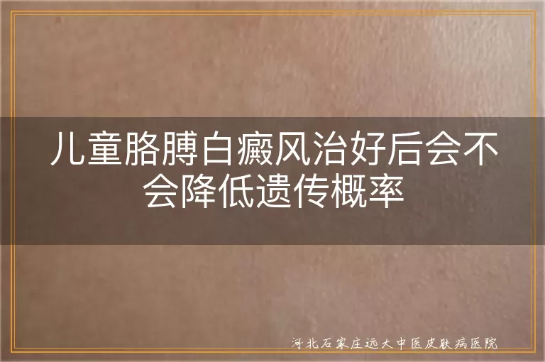 儿童胳膊白癜风治好后会不会降低遗传概率