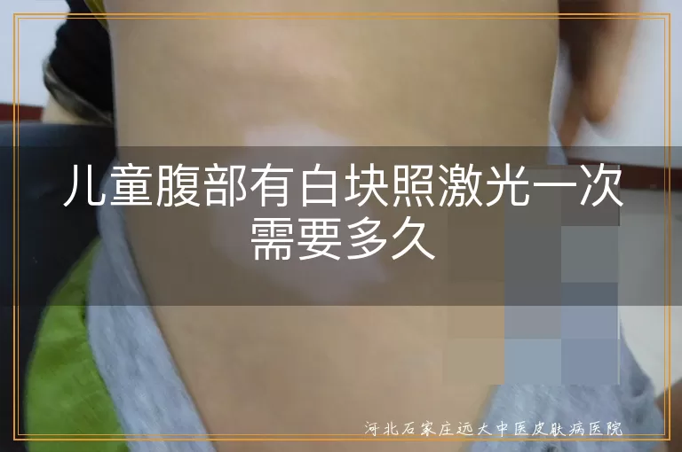 儿童腹部白斑激光疗程多久,腹部白癜风照308激光一次时长,孩子白斑腹部308准分子治疗时间