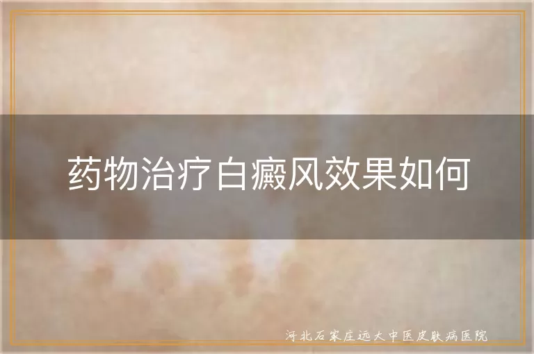 药物治疗白癜风效果如何