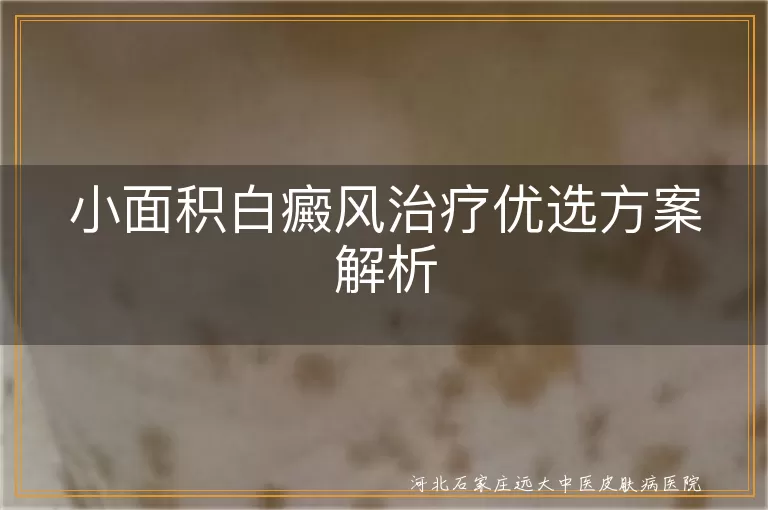 小面积白斑速愈攻略,白癜风微疗宝手札,白斑微创光疗笔记