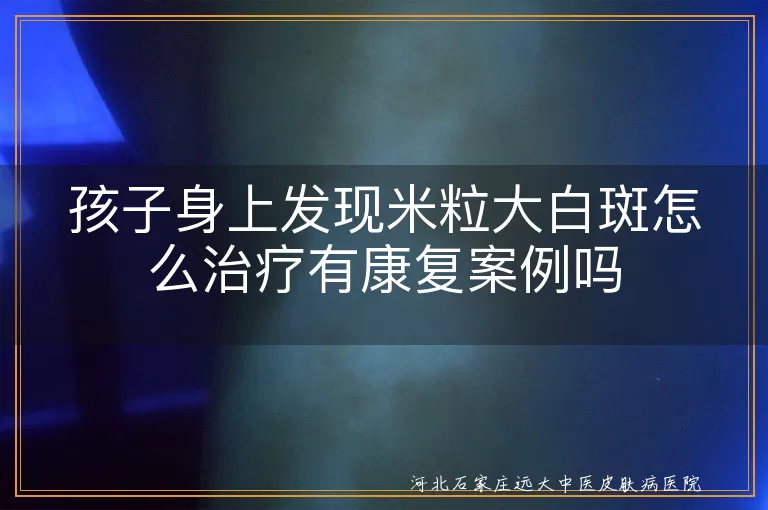 孩子身上发现米粒大白斑怎么治疗有康复案例吗