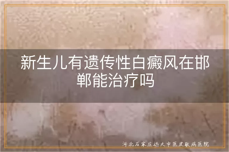 新生儿有遗传性白癜风在邯郸能治疗吗