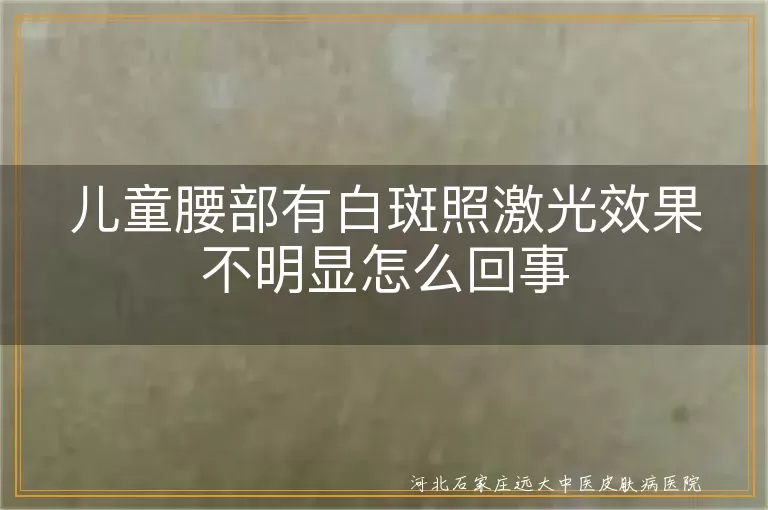 儿童腰部有白斑照激光效果不明显怎么回事