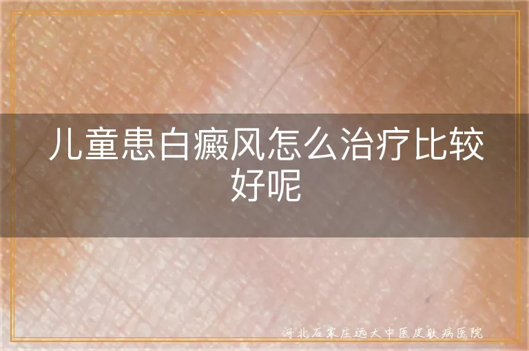 儿童患白癜风怎么治疗比较好呢