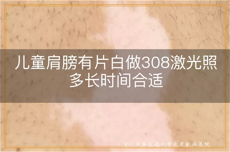 儿童肩膀有片白做308激光照多长时间合适