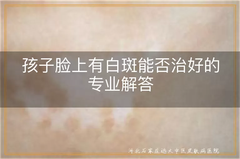 小儿面部白斑能根治吗,儿童白癜风早期治愈希望,幼儿白斑恢复几率