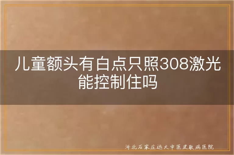 儿童额头白癜风激光控制,白斑仅靠308能停吗,308激光对付额头白斑