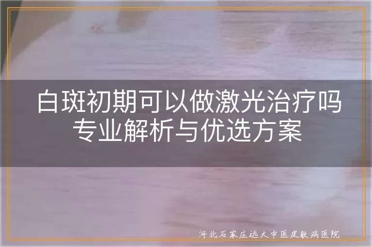 白斑初期可以做激光治疗吗专业解析与优选方案