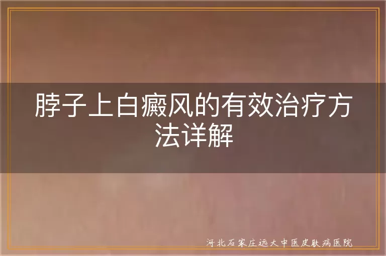 脖子上白癜风的有效治疗方法详解