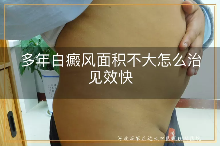 多年白癜风快速消退秘籍,白斑面积较小治疗妙招,小范围白斑复色捷径