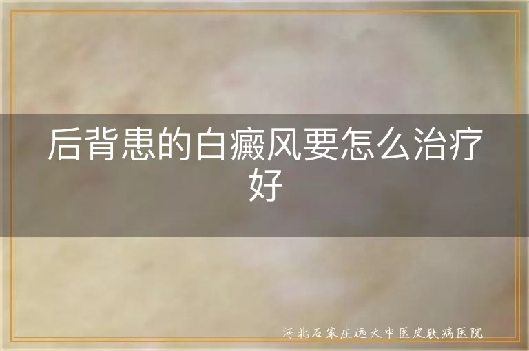后背出现白斑怎么治,背部白癜风如何治好,后背白癜风有效疗法