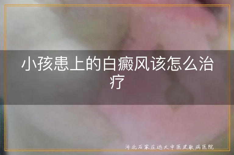 儿童白斑正确应对,低龄白癜风护理策略,宝宝白癜风康复指引
