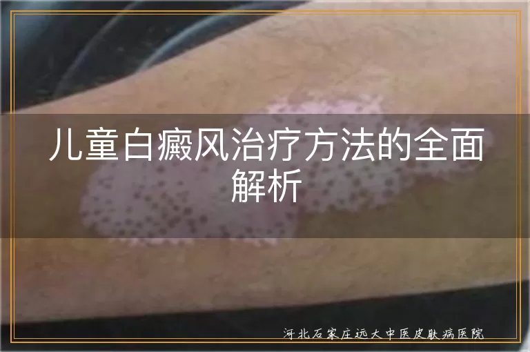 儿童白癜风治疗新思路,白斑早干预方案,白癜风患儿护理指南