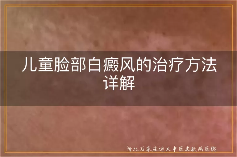 儿童脸部白斑的应对策略,脸部白癜风儿童治疗方案,小儿面部白斑治疗护理