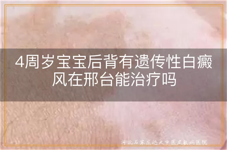 4周岁宝宝后背有遗传性白癜风在邢台能治疗吗