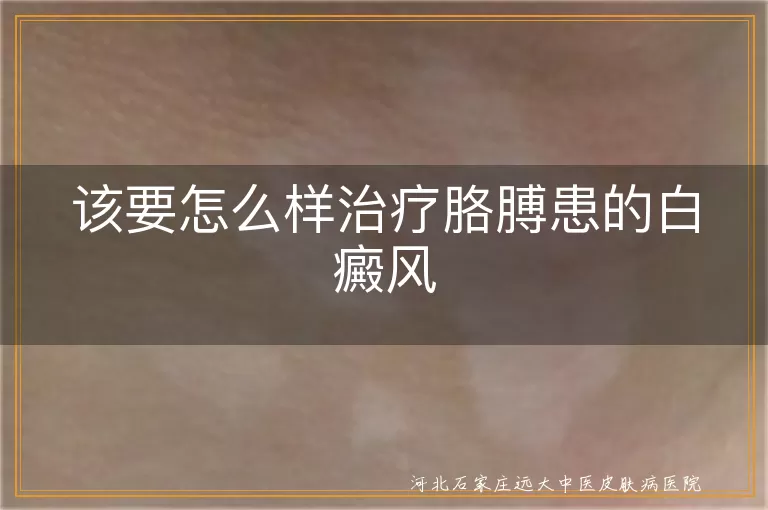 胳膊白斑科学疗法分享,白癜风日常护理要点,石家庄中医白癜风调理方案