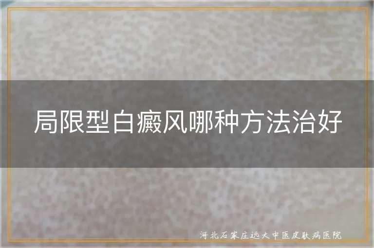 局限型白斑治疗选择,白癜风局部康复方案,白斑局限期怎么治