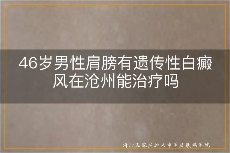 沧州肩膀白斑治疗,遗传性白癜风沧州能治吗,46岁男性白斑治疗