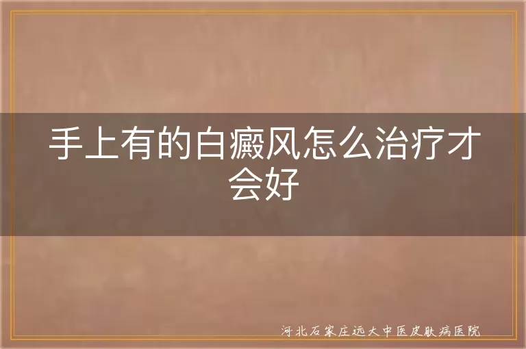 手指白斑怎么治才好,手掌白癜风康复方法,手部白斑科学治疗方案