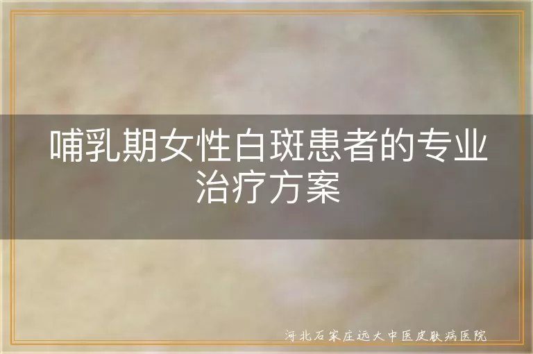 哺乳期女性白癜风治疗,哺乳白斑安全用药,白癜风母乳期护理