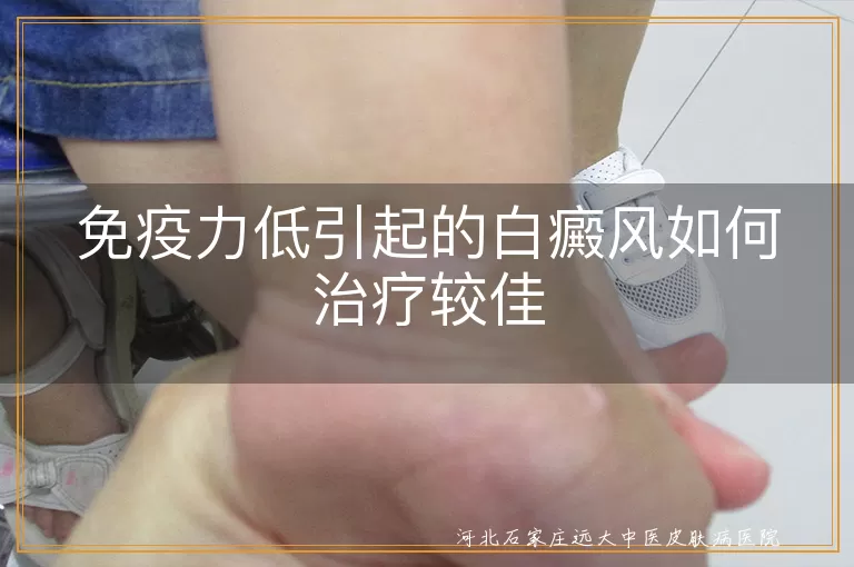 免疫力低下诱发白斑如何调治更佳,体质偏弱导致白癜风怎样干预更稳,免疫功能紊乱型白斑怎样应对更妥