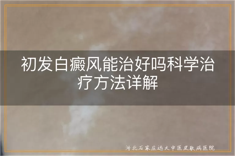 早期白斑能不能完全好转,白癜风初期治愈概率高吗,白斑初发阶段科学应对方法