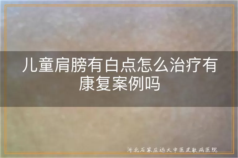 儿童肩膀有白点怎么治疗有康复案例吗