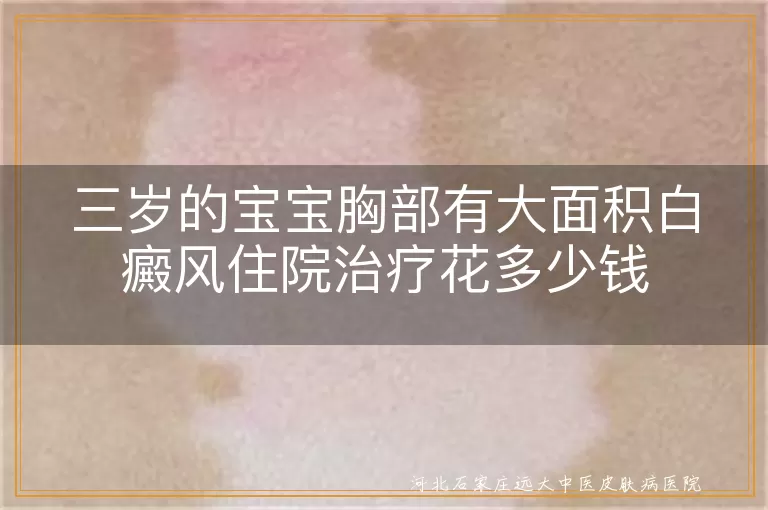 三岁的宝宝胸部有大面积白癜风住院治疗花多少钱