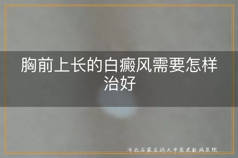 胸前上长的白癜风需要怎样治好