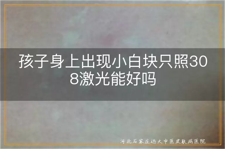孩子身上出现小白块只照308激光能好吗