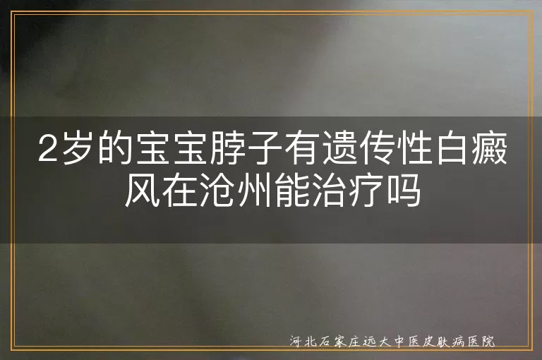 2岁的宝宝脖子有遗传性白癜风在沧州能治疗吗