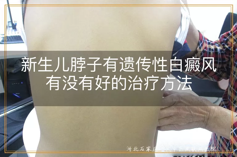 新生儿脖子有遗传性白癜风有没有好的治疗方法
