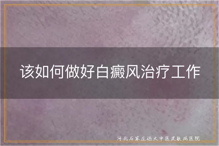 白癜风治疗策略,白斑规范用药方法,白癜风护理实操技巧