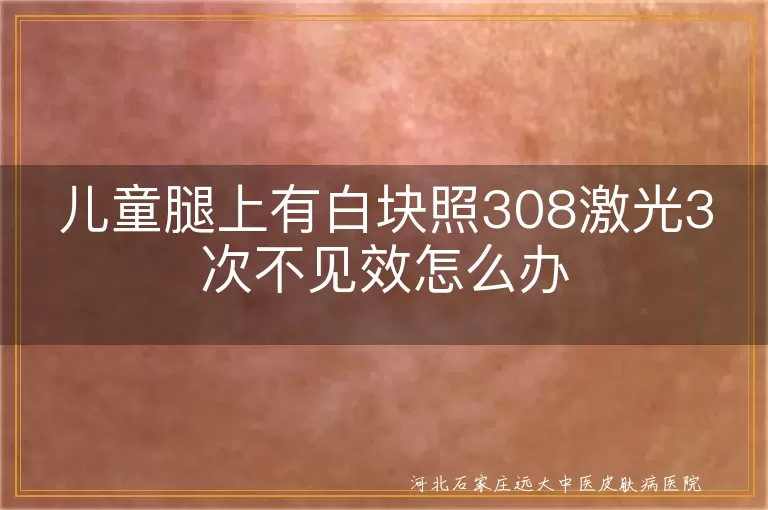 儿童腿上有白块照308激光3次不见效怎么办