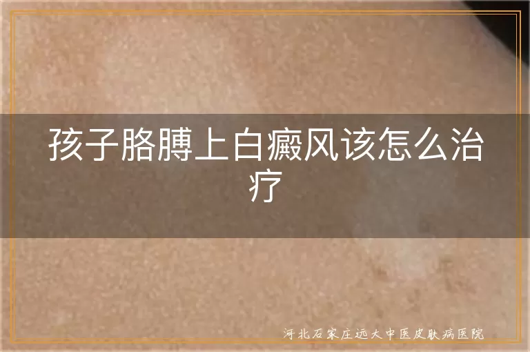 儿童胳膊白斑怎么治,小孩手臂白癜风治疗,孩子白斑初期干预办法