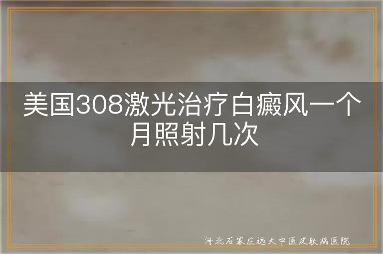 美国308激光治疗白癜风一个月照射几次